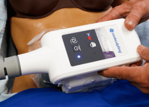 How Does CoolSculpting Work: Everything You Should Know
