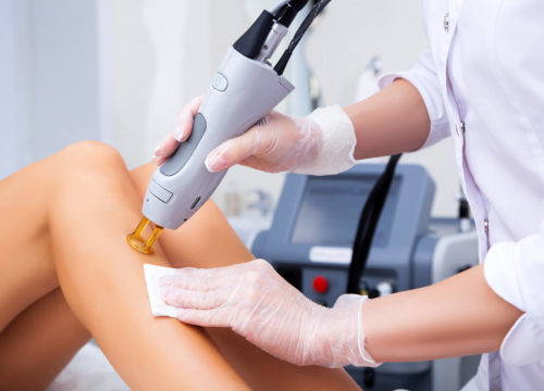 7 Amazing Benefits of Laser Hair Removal