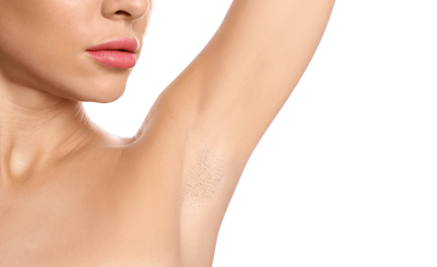 How to Prepare for Laser Hair Removal: Everything You Should Know