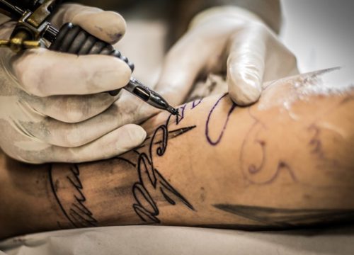 7 Signs You Need to Remove A Tattoo