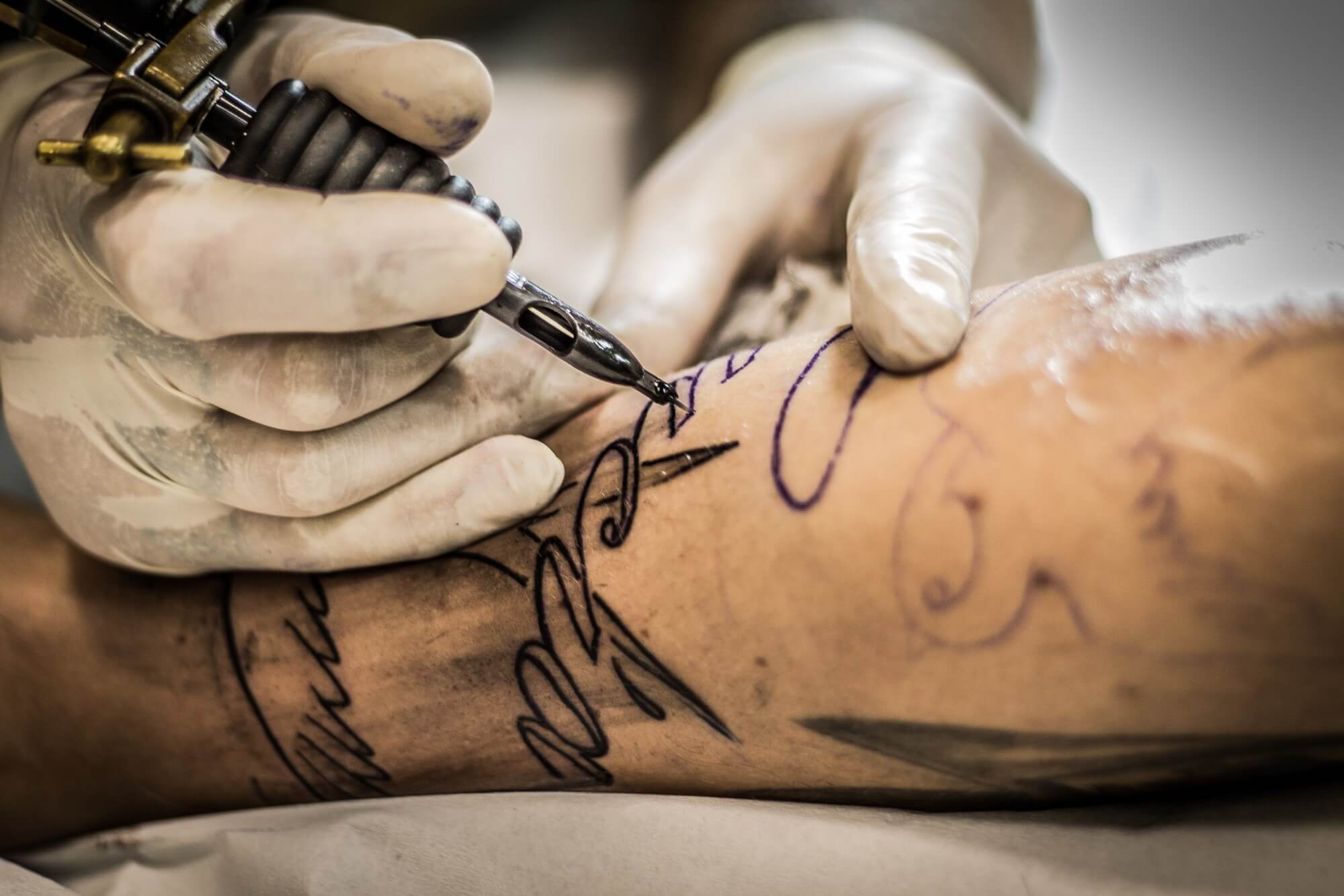 7 Signs You Need to Remove A Tattoo