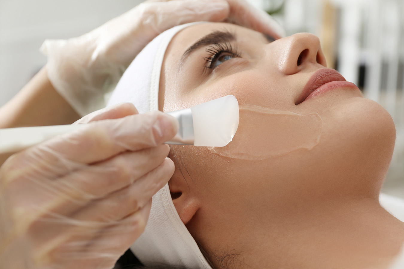 Chemical Peels  Boston - Skin MD Laser & Cosmetic Group