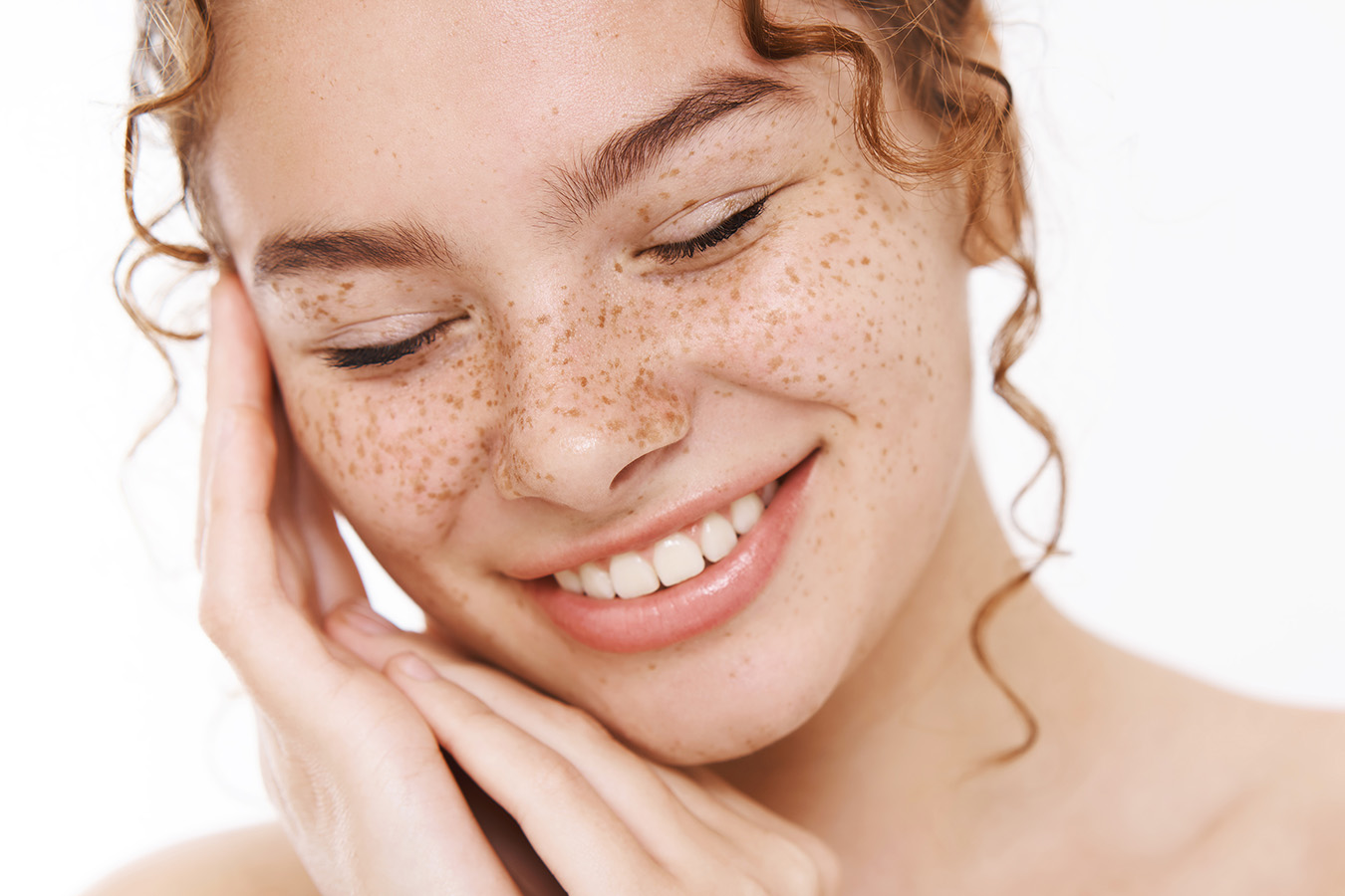 Freckles & Treatments | Skin MD Laser & Cosmetic Group