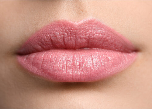 Kissable Lips for Less: Get $100 Off Kysse