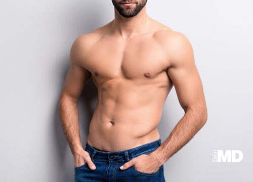 Male Muscle Makeover