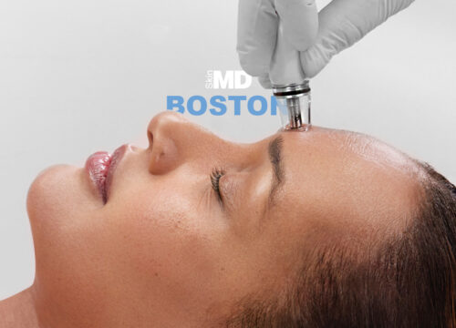 Photo of a woman getting a DiamondGlow treatment with Boston text in the background