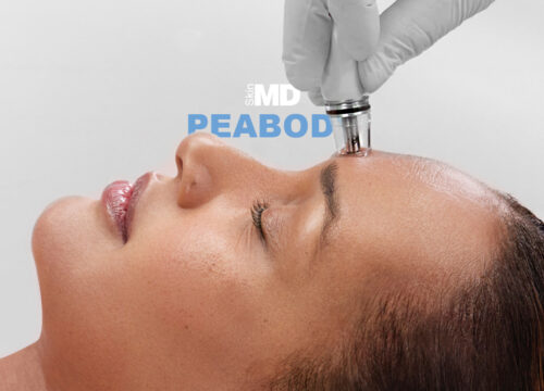 Photo of a woman getting a DiamondGlow treatment with Peabody text in the background