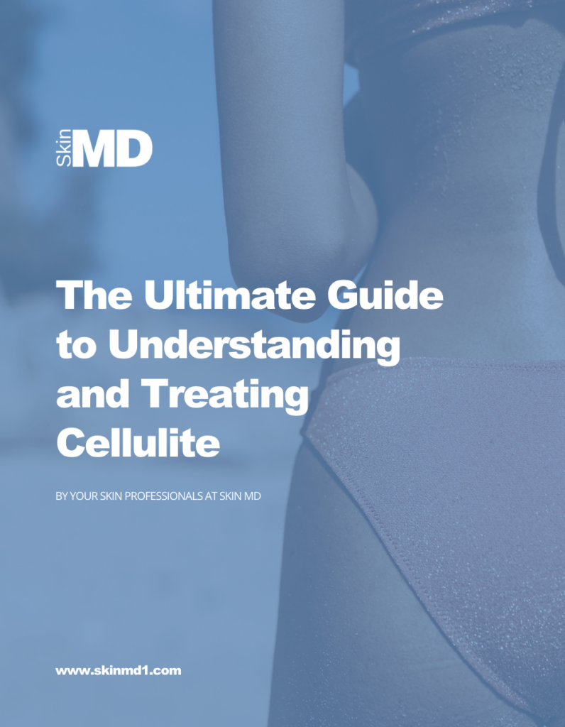 The Ultimate Guide to Understanding and Treating Cellulite