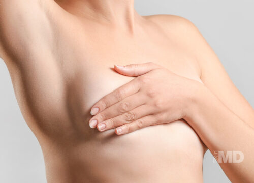 Love is in the AIR – Free Botox with Breast Augmentation