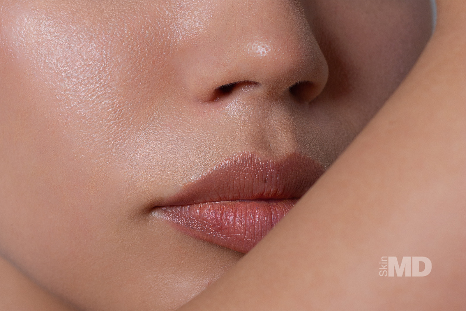 Kissable Lips for Less – $100 Off Kysse