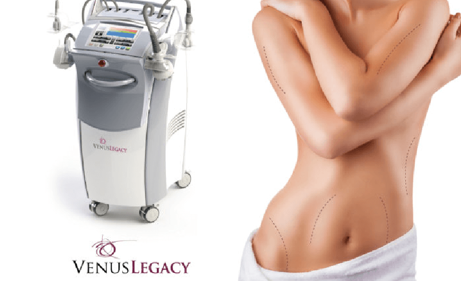 Venus Legacy Explained