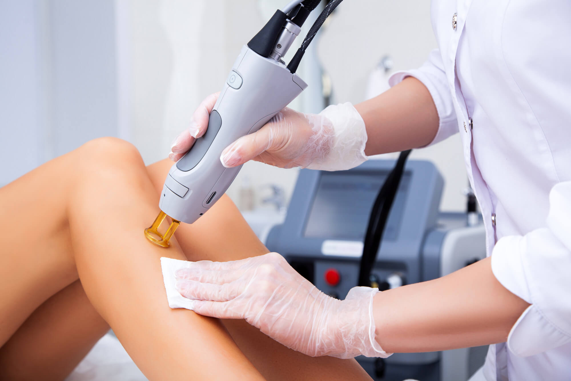 7 Amazing Benefits of Laser Hair Removal