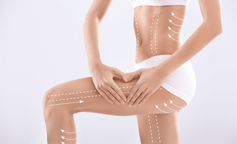 What to Expect After CoolSculpting Treatments: Recovery and Aftercare