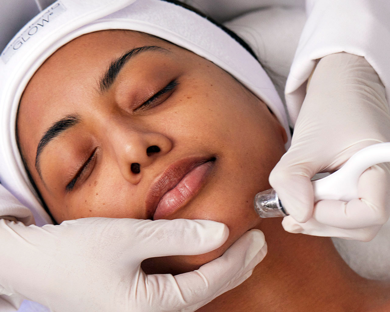 Meet Your Holiday Skincare Survival Pack, the Laser Facial