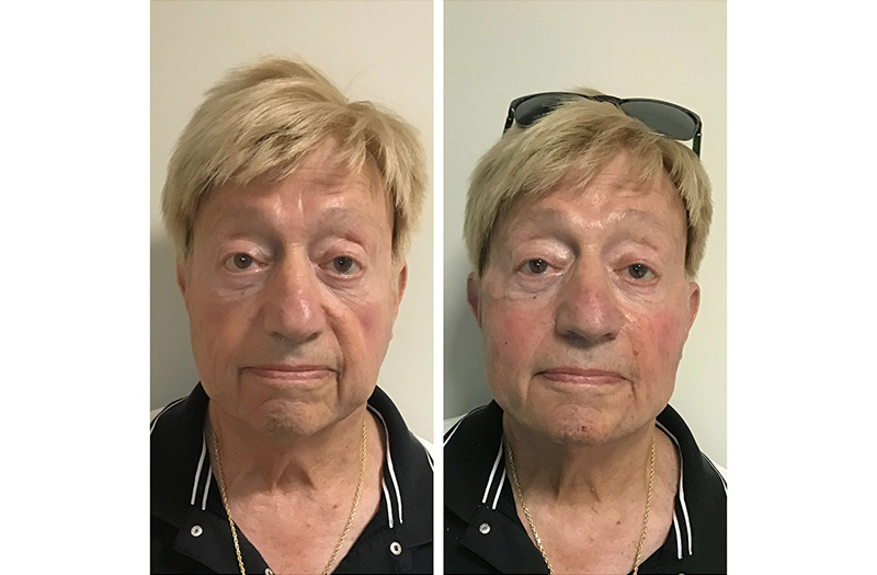 Combined-Image