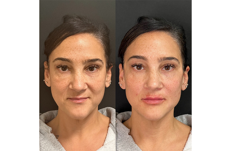 Combined-Image